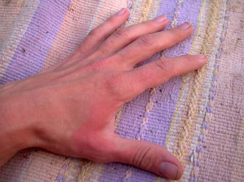 What Happens When Edd Opens An Urn On Your Hand